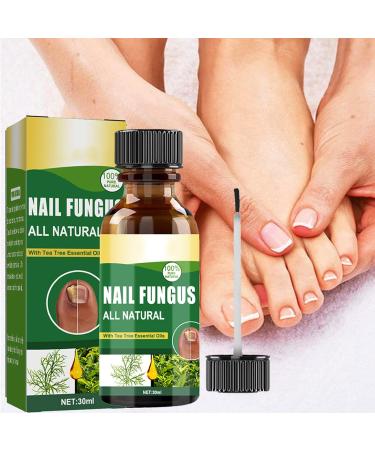 Antifungal Nail Treatment for Toe Fungus - 2-in-1 Solution to Treat and Prevent Nail Fungal Infections - Buy Online on GoSupps.com
