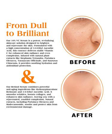 Sefralls Face Serum Duo Retinol Vitamin C Anti Aging Skin Care Set for Women Anti Wrinkle Smooth & Firm Skin 1 fl oz 2 Bottles - Buy Online on GoSupps.com