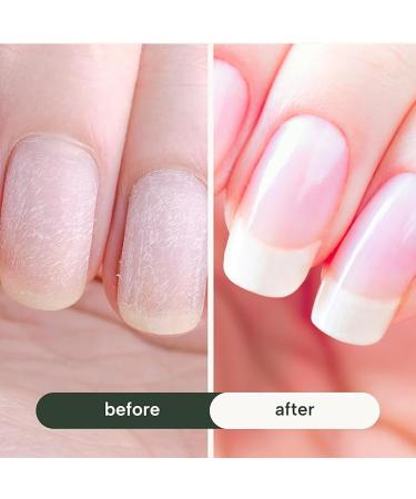 BeautyGARDE Rocket Nail Fuel - Nail Repair & Growth Treatment (0.5 Fl Oz) by Nonie Creme - Buy Online on GoSupps.com