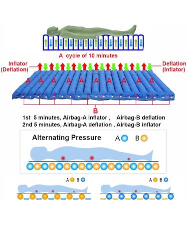 Samnuerly Interpreting Pressure Air Mattress | Pneumatic Massage Pillow & Pump for Bedridden Comfort - Buy Online on GoSupps.com