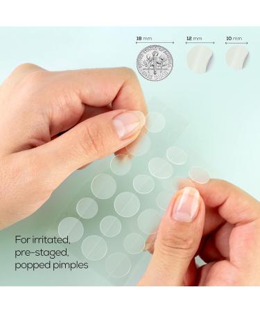HANHOO Soothing Blemish Patch with Aloe, Madecassic Acid & Tea Tree Extract | Hydrocolloid Spot Treatment (36 count) - Buy Online on GoSupps.com