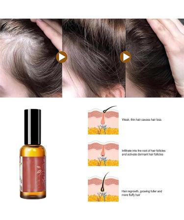 Avocado & Peppermint Hair Nourishment Oil - Avocado & Peppermint Oil for Dry Frizzy Brittle Hair & Hair Loss - Buy Online on GoSupps.com