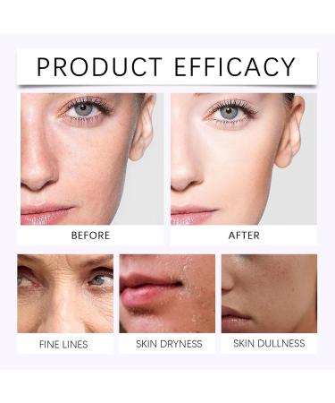 Dark Spot Corrector Glow Serum Whitening And Freckle Removing Essence Anti Spot Serum wrinkle power Dark Spot R Mover For Face Serum Korean Rapid Tone Repair Retinol Skin Care Face Body Cream - Buy Online on GoSupps.com