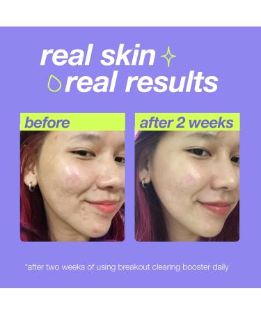 Dermalogica Clear Start Breakout Clearing Booster - Acne Spot Treatment with Salicylic Acid | 1 Fl Oz - Buy Online on GoSupps.com