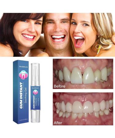 Attdx Gum Instant Treatment Gel - Natural Gum Therapy for Sensitive Teeth (1PC) - Soothing Relief & Oral Care - Buy Online on GoSupps.com
