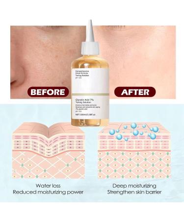 Glycolic Acid Toner Glycolic Acid 7% Toning Solution Glycolic Acid 7% Hydrating Serum Skin Glycolic Acid Serum Toner Skincare Hydrating Moisturiser Resurfacing Solution Brightening Serum Facial Serum - Buy Online on GoSupps.com