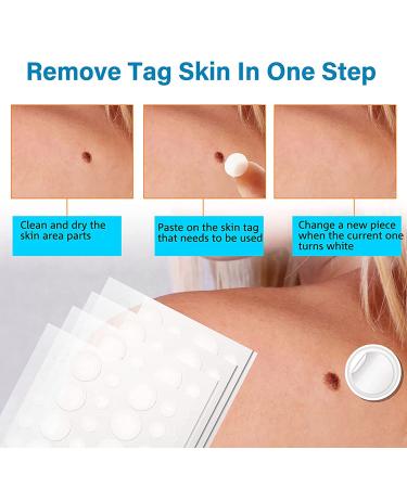 Skin Tag Remover Patches - 144Pcs | Safe & Painless Wart Removal for Face & Body - Buy Online on GoSupps.com