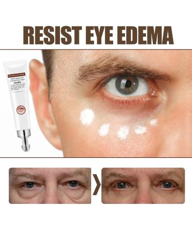 Keptfeet Anti-Aging Eye Cream - Fast Wrinkle Repair for Dark Circles & Swelling | 20g Youthful Skin Treatment - Buy Online on GoSupps.com