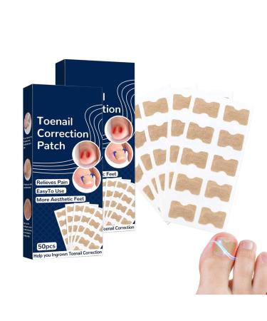 100 PCS Toenail Correction Patch  Breathable Self-Adhesive Elastic Toenail Correction Patch  Health Toenail Corrector Patch  Ingrown Toenail Correction Stickers Blue