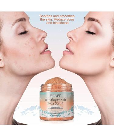 Premium Himalayan Salt Body Scrub with Lychee Oil Natural Exfoliating Salt Scrub for Acne Cellulite Deep Cleansing Scars Wrinkles Exfoliate and Moisturize Skin - Buy Online on GoSupps.com