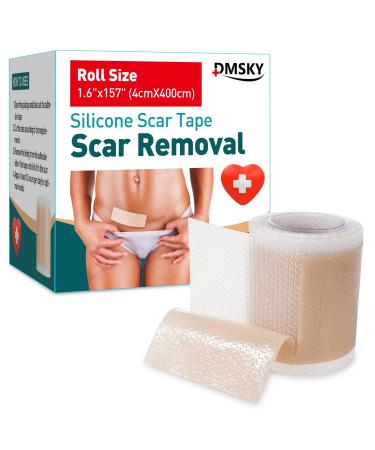 Silicone Scar Sheets 1.6 x 157 Roll-4M Scar Removal Sheets  Medical Silicone Care Tape for Hypertrophic Scar  C-Section and Acne Scar  Keloid Surgery Scars Sheets  Stretch Marks Silicone Tape