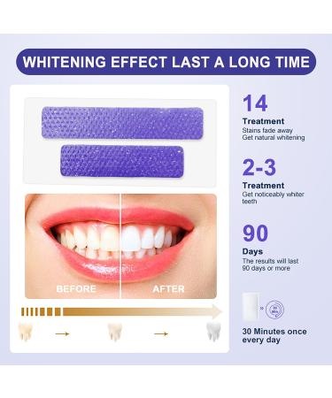 Teeth Whitening Strips - Non-Sensitive & Professional Kit for Smokers & Coffee Drinkers | 28 Strips (14 Treatments) | Mint Flavored - Buy Online on GoSupps.com