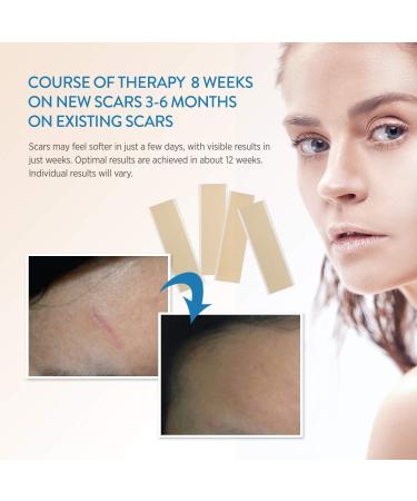 Aroamas Silicone Scar Removal Sheets 4 pcs White Professional, Drug-Free Solution for Burn, Keloid, Acne, Surgery Scars Soft Adhesive Fabric Strips, 2 Month Supply - Buy Online on GoSupps.com