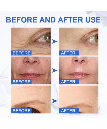 Boto-x Stock Solution Facial Serum Boto-x Stock Anti Aging Serum For Face Instant Face Serum Reduce Fine Lines Wrinkles Boost Skin Collagen Anti-Wrinkle Serum Hydrate & Plump Skin Boto-x Serum - Buy Online on GoSupps.com