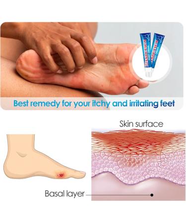Foot Cream 20g Softening Heel Balm - Moisturizing Foot Cream - Daily Care After Showering and Bedtime in Winter and Dry Climates at Home or While Traveling - Buy Online on GoSupps.com
