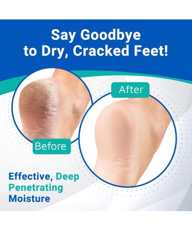 Dermal Therapy Heel Care Cream - 25% Urea & 6% AHA for Dry Cracked Heels | 8 oz | Packaging May Vary - Buy Online on GoSupps.com