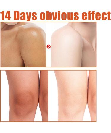 Dark Knuckles Remover From Hand Dark Spot Correcting Glow Serum Lightweight Body Oil Whitening Serum Hyperpigmentation Dark Spot Remover For Hand & Foot & Body Brightening Body Oil For Darkness 1pc - Buy Online on GoSupps.com