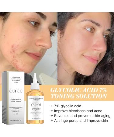 Glycolic Acid 7% Toning Solution Glycolic Acid Toner Hydrating Toner Glycolic Acid Serum Improve Blemishes&Acne and Spots Anti Aging Exfoliating Toner for Face Toner for Oily Skin 100ml - Buy Online on GoSupps.com
