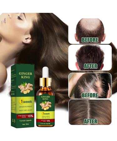 Ginger Oil Hair Growth Natural Hair Density Essential Oil Skin 100% Pure Essential Oil Aromatherapy Repair Skin Hair Growth Oil Strengthens Hair (Ginger 30 ml) B - Buy Online on GoSupps.com