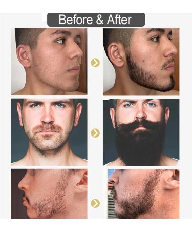 Beard Oil Spray Beard Growth Oil For Men Natural Formula Beard Growth Serum Nourishing Promote Beard Facial Hair Regrowth Mens Beard Oil Spray Moisturizes Softens&Strengthens Beard Care For Men - Buy Online on GoSupps.com