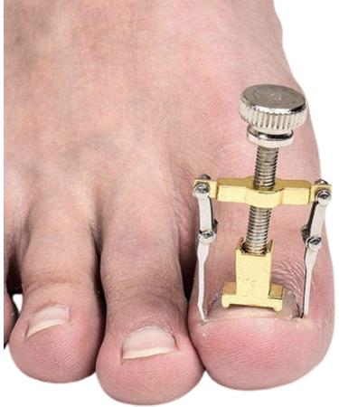 GLAMZA Ingrown Toenail Corrector Clamp - Safe & Effective Treatment Tool - Buy Online on GoSupps.com
