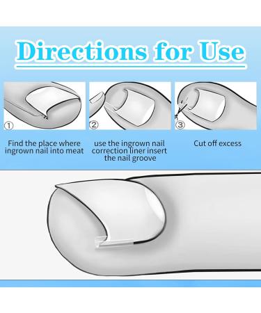 Buy 50+1 Pcs Ingrown Toenail Treatment Kit - Professional Pain-Free Correction & Removal Set for Men & Women - Buy Online on GoSupps.com