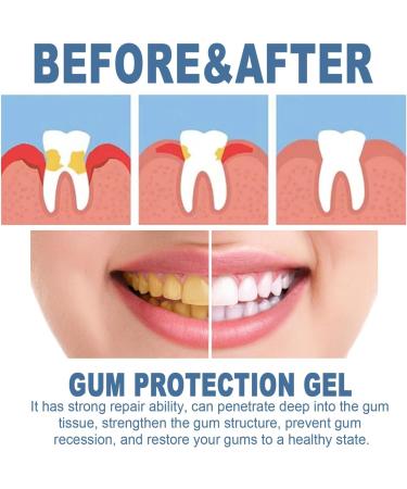 Advanced Gum Therapy Gel - Repair Swelling & Strengthen Gums (4 Pieces) - International Shipping Available - Buy Online on GoSupps.com