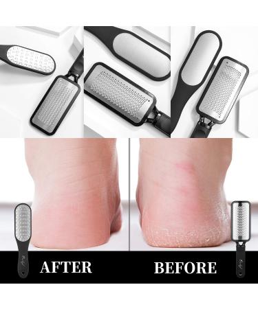 Oneleaf Professional Pedicure Kit - Foot File & Callus Remover for Smooth & Beautiful Feet - Includes Bag - 2pcs (Black) - Buy Online on GoSupps.com