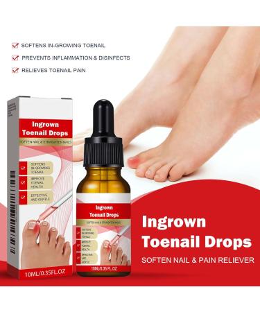  Mwqpgyh Nail and Toenail Strengthening Liquid 10ml Ingrown Toenail Corrector Drops Nighttime Travel Beauty Treatment for Dry Damaged Cracked Curved Fragile and Chipped Nails - Buy Online on GoSupps.com