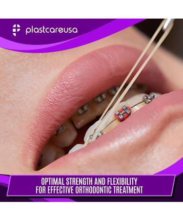 1000 Assorted Colors Orthodontic Elastic Bands for Braces | Medium 4.5 Oz Multi-Sized & Tension Dental Bands for Teeth Alignment | Latex Free | 10 Bags of 100 - Buy Online on GoSupps.com