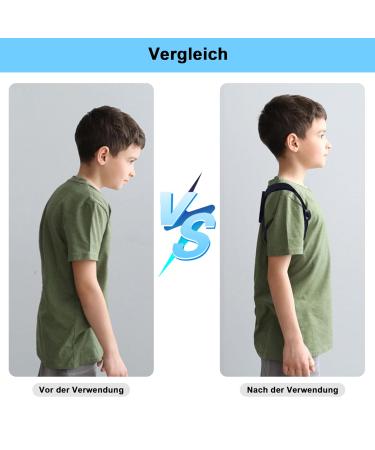 Back Bodyguard Posture Corrector - Electronic Monitoring & Vibration Back Support - Adjustable Stabilizer for Improved Posture (Black) - Buy Online on GoSupps.com