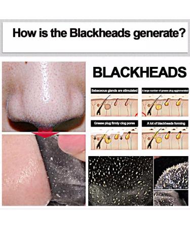 Deep Cleansing Blackhead Black Mud Mask - Purifying Peel for Acne & Pimples Removal | International Shipping Available - Buy Online on GoSupps.com