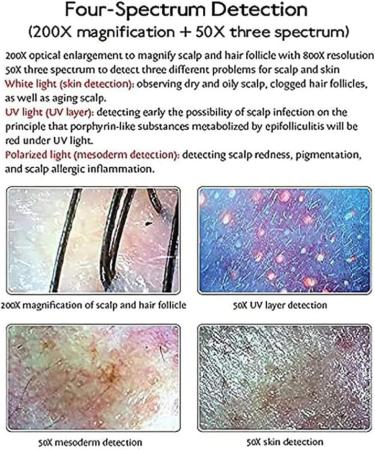 SDTOOP 15.5 Inch HD LCD Screen Microscope Tester for Hair Follicles Facial Skin Oil Moisture Health Detection Machine for Home Salon Use - Buy Online on GoSupps.com