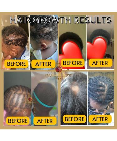 Extra Strength Hair Growth Oil | Essential Oils for Thinning Hair & Dry Scalp | All Hair Types - Buy Online on GoSupps.com