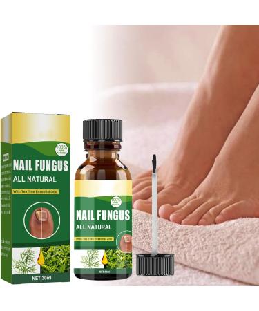 Antifungal Nail Treatment for Toe Fungus - 2-in-1 Solution to Treat and Prevent Nail Fungal Infections - Buy Online on GoSupps.com