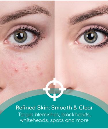 Medi Grade Blackhead Remover Tools - 7 Skincare Tools with Oil Absorbing Blotting Paper - Pimple Popper Spot Treatment Kit - Buy Online on GoSupps.com