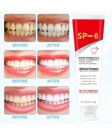 2 Pcs Sp-6 Fresh Breath Toothpaste Sp-6 Toothpaste Probiotic Toothpaste Sp-6 Toothpaste Sp-6 Ultra Whitening Sp-6 Toothpaste Sp-6 Fresh Breath Toothpaste Probiotic Toothpaste Sp-6 - Buy Online on GoSupps.com