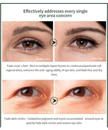 Rollerball Castor Oil For Eyes Eyes Gum Roller 10ml Frankincense Eyes Moisturizing Brighten Eye Roller Skin Care Products Sensitive Skin Promotes Firming & Tightening For Women Men - Buy Online on GoSupps.com