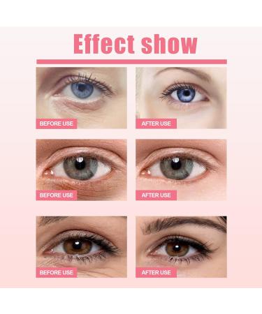  Dyceittdia Set of 2 eye creams with rosehip brightens the eyes reduces puffiness and fine lines firms the eye contour 2 x 3 g eye cream - Buy Online on GoSupps.com