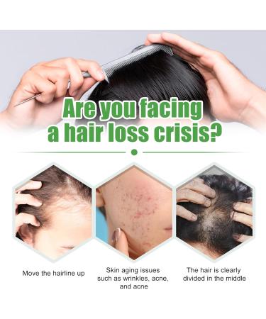 Castor Oil for Hair Growth Pure Naturals Cold Pressed Hair Growth Oil for Women Men Promote Hair Growth Strengthen Hair Roots and Prevent Bifurcation 60ML - Buy Online on GoSupps.com