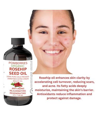 Premium Organic Rosehip Oil | Cold-Pressed Anti-Aging Face Oil | Reduces Wrinkles & Rich in Vitamin C | Natural Skin Care Moisturizer - Buy Online on GoSupps.com