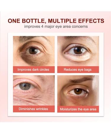 Eye Cream for Dark Circles and Puffy Eyes - Caffeine Eye Cream - Eye Cream Anti Aging for Eye Bags - Improve Eye Area Concerns - Anti Wrinkle Eye Cream Aiming at Lightening Eye Lines - Buy Online on GoSupps.com