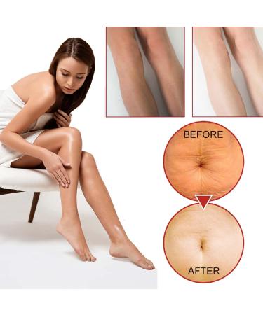 B Glossy Body Serum for Wrinkles Hydrating Serum Hydrating & Firming Anti-Aging & Wrinkle Smoothing Formula with Vitamin E Hyaluronic Acid Fast-Absorbing - Buy Online on GoSupps.com