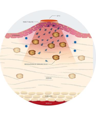Bite Away 2 Pack Insect Sting Relief Treatment - Chemical-Free, FDA-Cleared, Dermatologist-Tested for Fast Symptom Relief, Reduce Pain & Itching, FSA/HSA Eligible - Buy Online on GoSupps.com