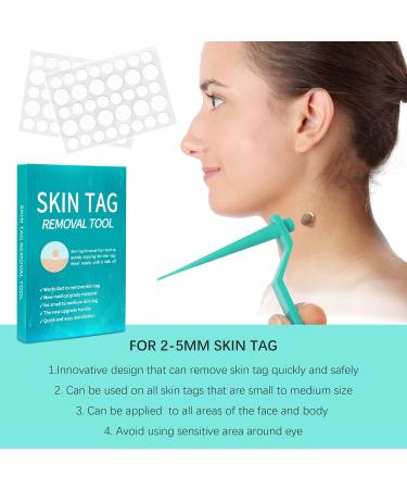 Skin Day Distant Micro Skin Tag Removal Kit - Efficiently Remove Small Skin Tags (4mm & Below) with 20 Ribbons & 72 Patches - Buy Online on GoSupps.com