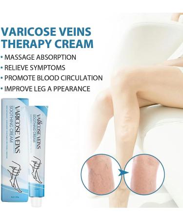 Raura Varicose Veins Treatment Cream Raura Varicose Veins Cream Varicose Veins Treatment for Legs (1) - Buy Online on GoSupps.com