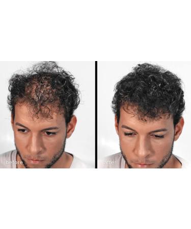 MAXX PRO Series Volumizing Hair Fibers with Real Keratin | Hypoallergenic & Dermatologist Tested | 60 Days Supply for Hair Loss (Gray) - Buy Online on GoSupps.com