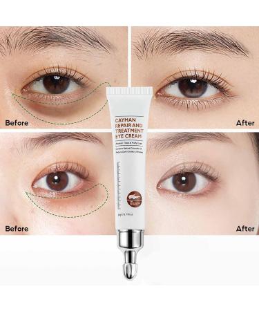Axoeye Renew Peptide Lifting Eye Gel Peptide Lifting Eye Gel for Women Magic Eye Cream 28 Seconds to Remove Eye Bags Awaken Peptide Lifting Eye Gel for Wrinkles/Dark Circles/Puffiness (2PCS) - Buy Online on GoSupps.com
