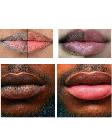 Natural Lip Scrub 20g for Dark and Dry Lips | Smoker's Balm for Men and Women | Exfoliating Moisturizer for Dark Lip Lightening - Buy Online on GoSupps.com