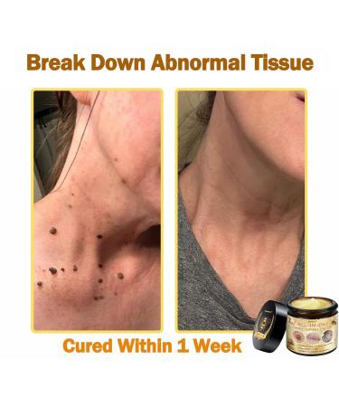 Bee Venom All-in-One Cream Bee Venom Skin Treatment Cream bee venom skin repair cream for Face and Body Professional Moisturizing for All Skin Types (1) - Buy Online on GoSupps.com